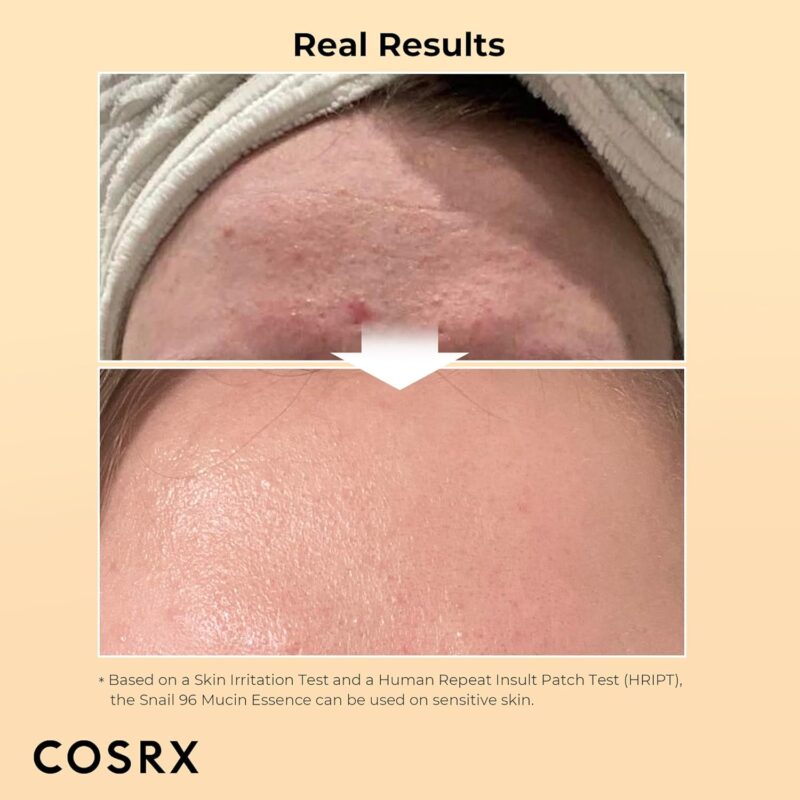 Cosrx, Advanced Snail 96 Mucin Power Essence , 3.38 Fl Oz (100 ml) Brand: COSRX - Image 2