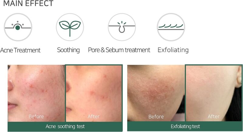 SOME BY MI "" AHA.BHA.PHA 30 Days Miracle Foam (100 ml) - Image 5